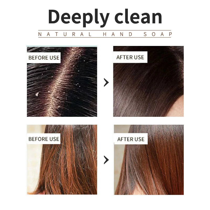 Lavender Shampoo Oil Control Refreshing Hair Smooth Oily Scalp Solution No Silicone Oil