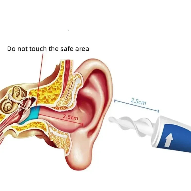 Portable Spiral Ear Wax Remover Tool Ear Cleaner with Soft Silicone 16 Replacement Tips Simply To Grab Extract Earwax
