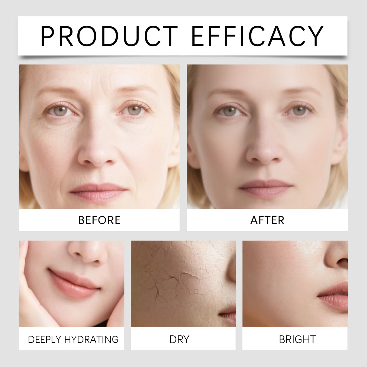 Niacinamide Microneedle Serum Facial Serum Kit 0.25mm Moisturizing Skin Nourishing Winter Skincare Face Roller Day Cream 30ml