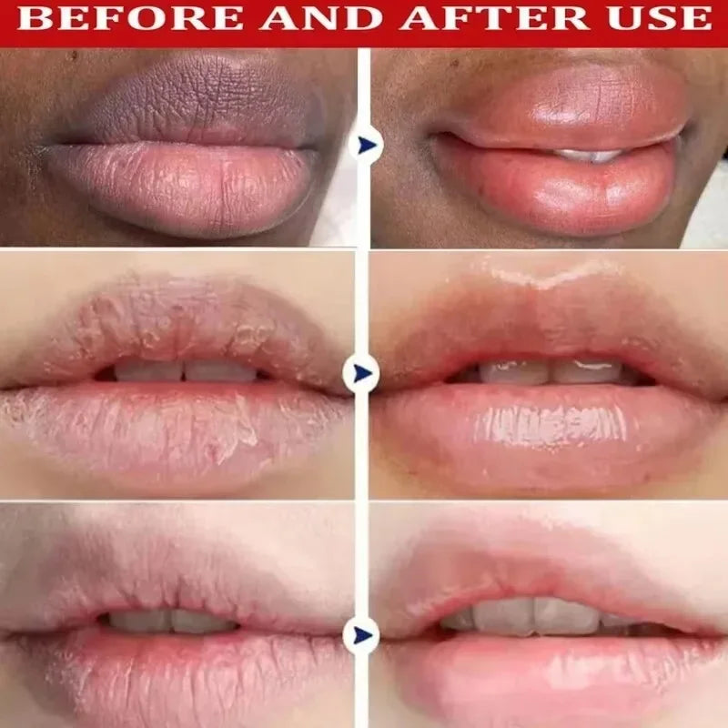 Dark Lip Treatment Balm Serum – Lip Lightening & Brightening Mask for Pigmentation, Melanin, Dark Lips, Lip Lines & Dead Skin – Nourishing Repair Lip Care