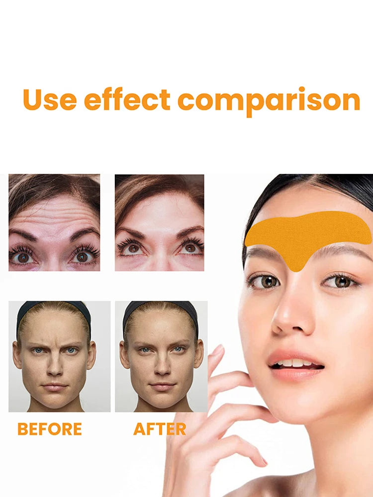 The Forehead Wrinkle Patch Can Lift The Face And Tighten The Skin The Forehead Patch Can Fade And Smooth The Forehead Wrinkles