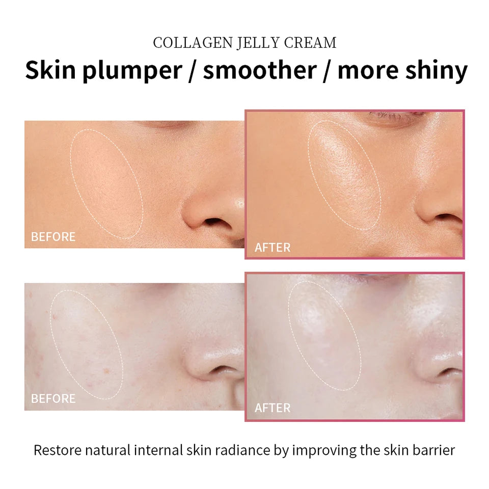 Moisturizing Collagen Jelly Cream Niacinamide Hydrolyzed Collagen Tightening Soothing Anti-Aging Firmness Hydration Skincare